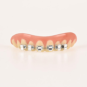 10112 Dientes con Brackets