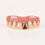 10052 Dientes con Diente de Oro