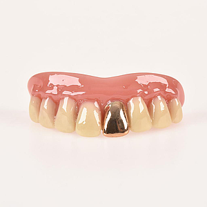 10052 Dientes con Diente de Oro