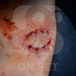 Prostético de Mordida Zombie Chica