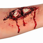 WO163 Prostético de Hueso Roto