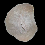 Cicatriz Mod. 3 cortada abierta