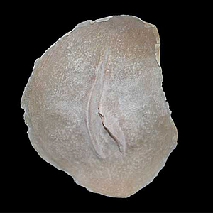 Cicatriz Mod. 3 cortada abierta